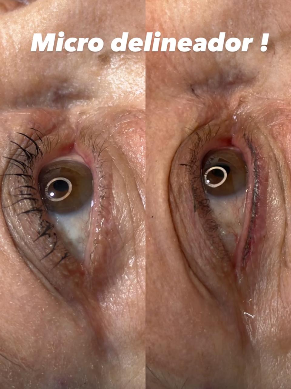 Resultado real de micro delineador de olhos